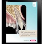 Patient Assessment and Extraction