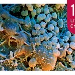 Hu-Friedy Biofilm Webinar