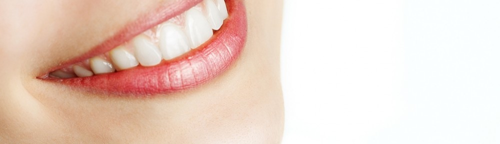 smile whitening marketing materials