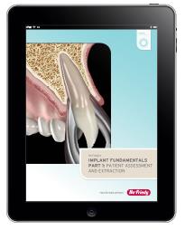 Implant Fundamentals Part 1: Patient Assessment and Extraction