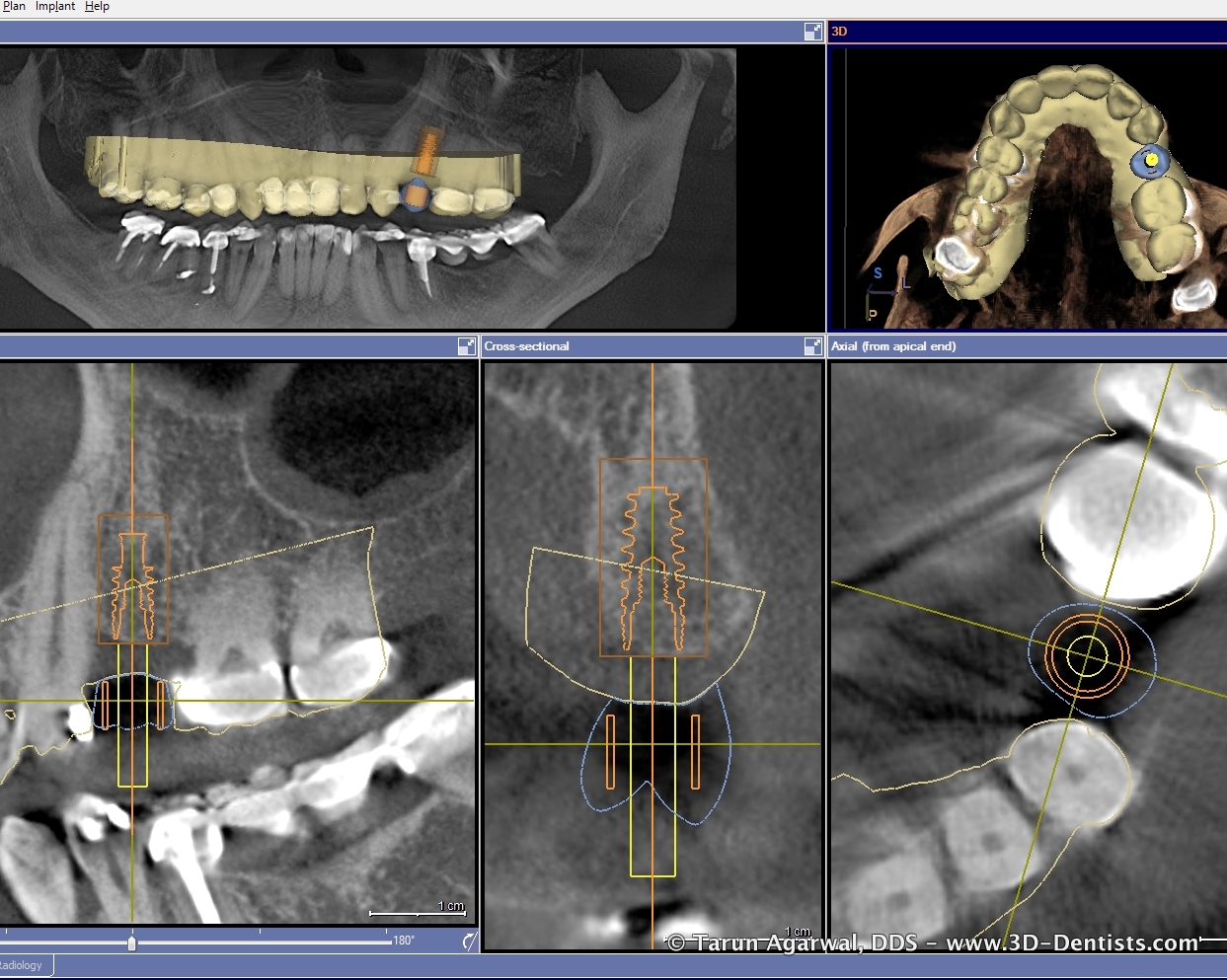 cerec guide 2 cerec guide 2