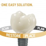 CEREC Guide 2