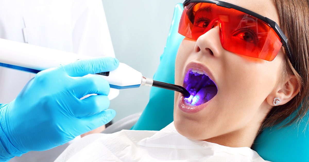 Everything you need to know about dental curing lights - Off the Cusp