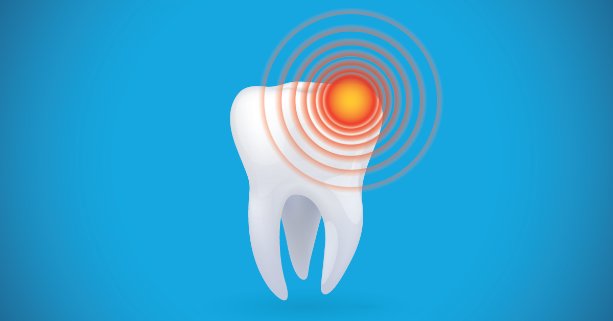 Illustration of a teeth showing sensitivity