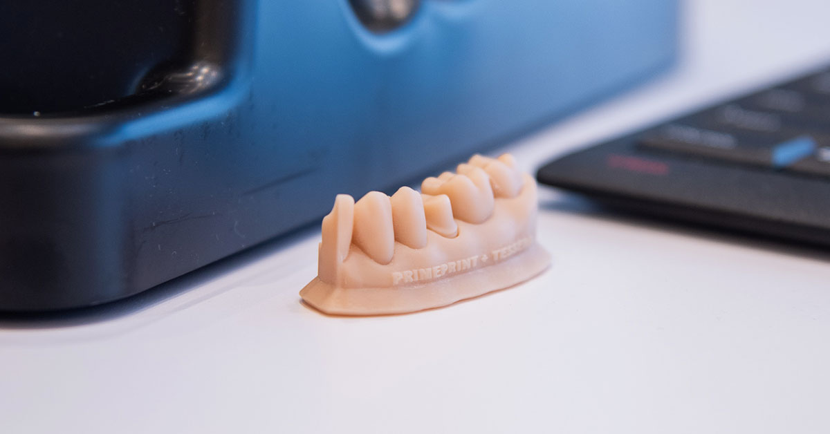 3D printing in dentistry: Resins applications - Off the Cusp